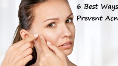 6 Best ways to Prevent Acne