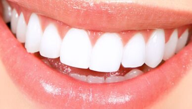 Best Teeth Whitening Home Remedies to Lighten up your Life