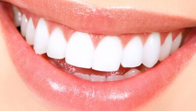 Effective Teeth Whitening Tips