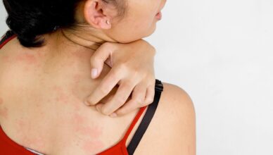 Get Rid of Itchy Skin with Home Remedies