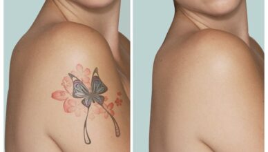 Simple and Easy Tips to Get Rid of Tattoos