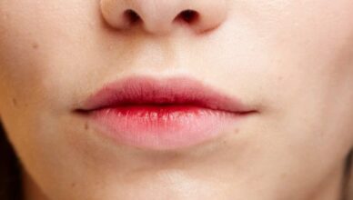 Some Effective Remedies for Chapped Lips