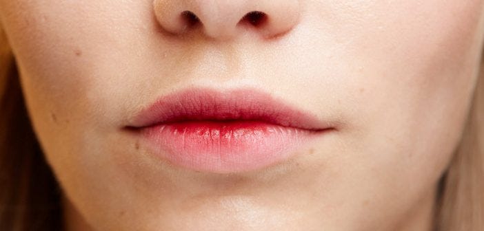 remedies for chapped lips