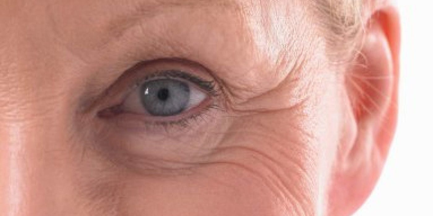 Natural Remedies for Wrinkles