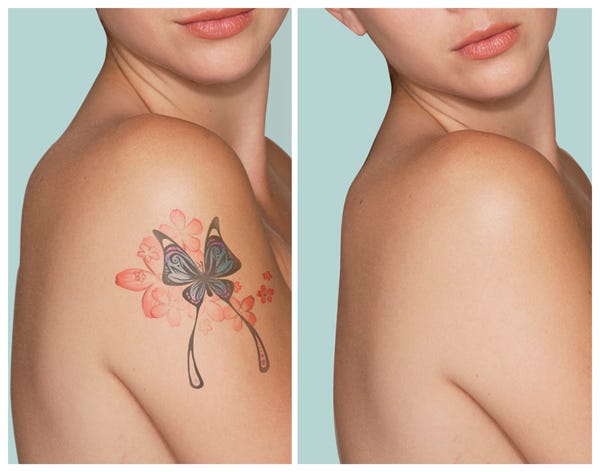 get rid of tattoos naturally