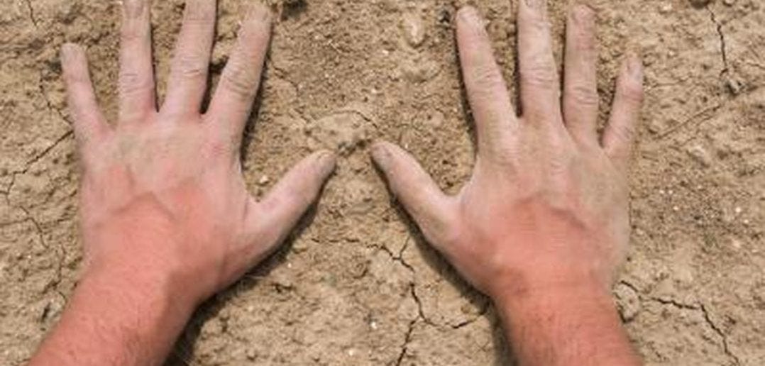 remedies for dry chapped hands