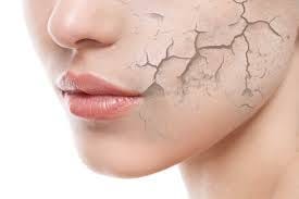 remedies for dehydrated skin