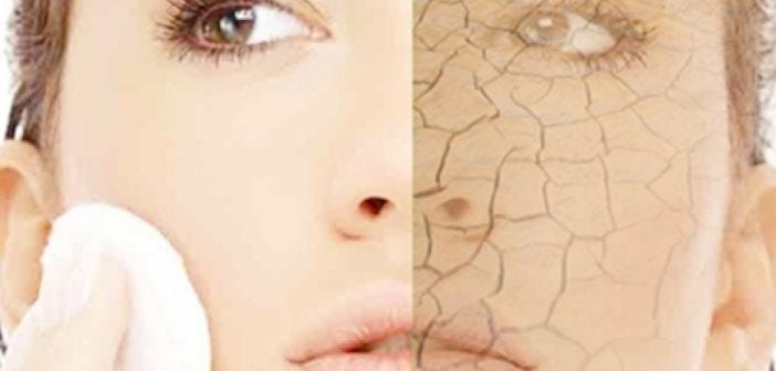 remedies for dry skin