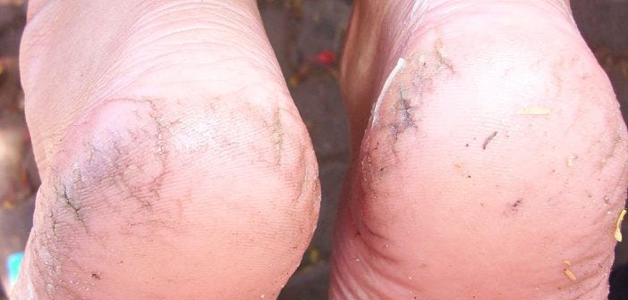 diy tips for soft feet